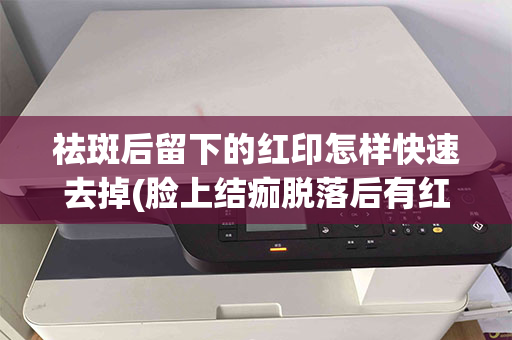 祛斑后留下的红印怎样快速去掉(脸上结痂脱落后有红印怎么消除)